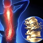 Spinal